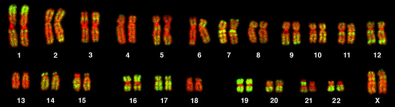 22 autosomes and 2 XX chromosomes